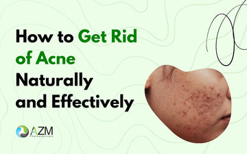 How to Get Rid of Acne Naturally and Effectively