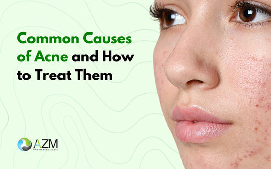 Common Causes of Acne and How to Treat Them