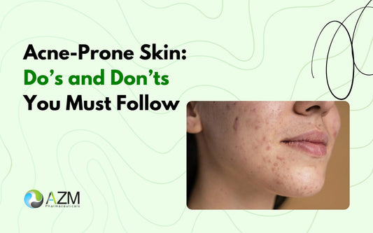 Acne-Prone Skin: Do’s and Don’ts You Must Follow