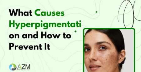 What Causes Hyperpigmentation and How to Prevent It