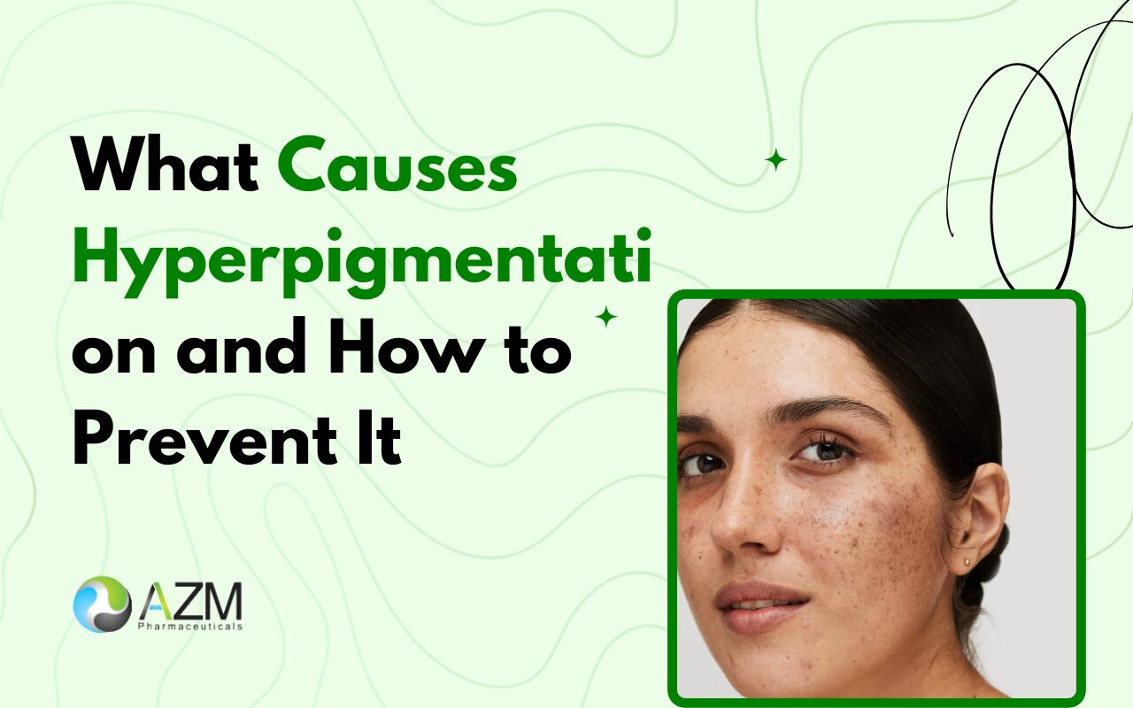 What Causes Hyperpigmentation and How to Prevent It