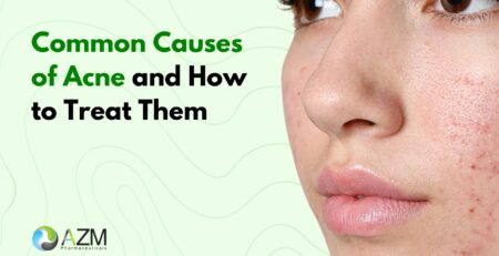 acne skincare routine, oily skin care, acne prevention tips, clear skin guide, acne treatment tips, dermatologist skincare advice, skin hygiene, acne causes, daily skincare routine, AZM Pharmaceuticals