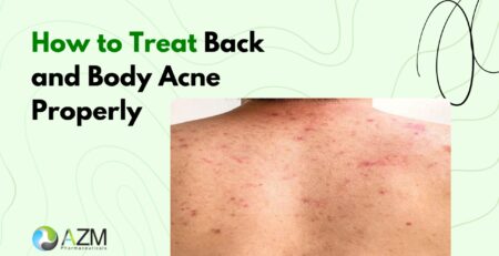 body acne treatment, back acne care, bacne routine, acne prone skin, oily skin care, dermatologist skincare advice, anti acne skincare, clear skin guide, daily skincare routine, AZM Pharmaceuticals